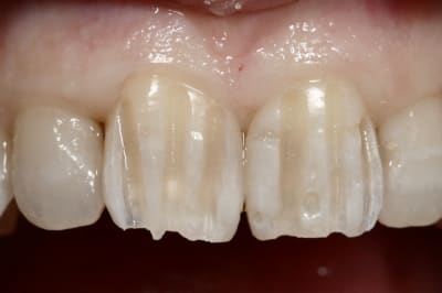 Img 6980 snu3vg - Eugenol