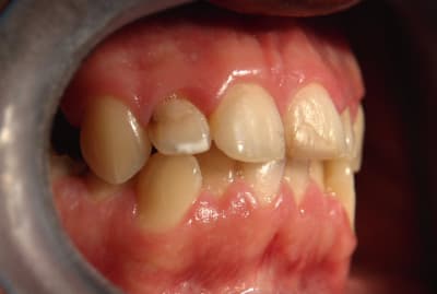 Img 7248 wgfduf - Eugenol