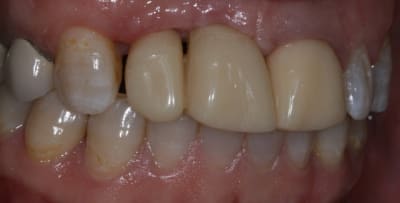 Img 7282 gkurke - Eugenol