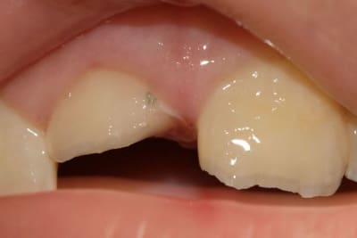 Img 7315 dxo raw uv1bit - Eugenol