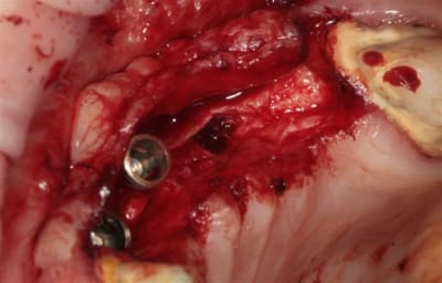 Img 7589 hdlmwj - Eugenol