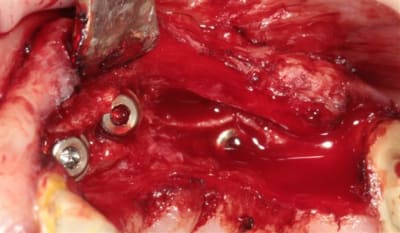 Img 7592 lglv9x - Eugenol