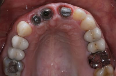 Img 7626 pkwjno - Eugenol