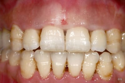 Img 7732 k1e2ur - Eugenol