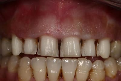 Img 7733  custom  frwjas - Eugenol