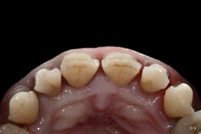 Img 7737 qlysui - Eugenol