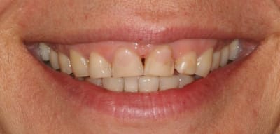 Img 7800 infixj - Eugenol