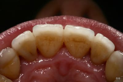 Img 7818 y8dscx - Eugenol