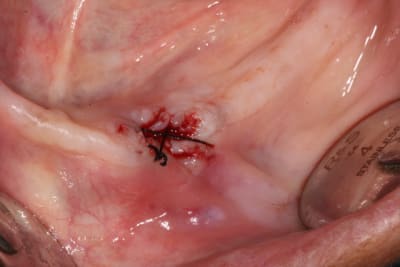 Img 7823 tqptco - Eugenol