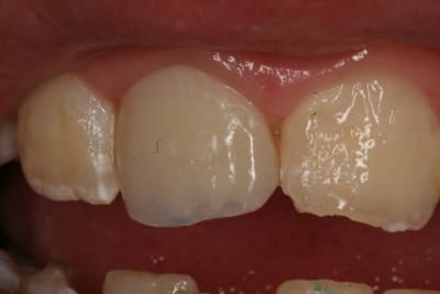 Img 7921 qcigbr - Eugenol
