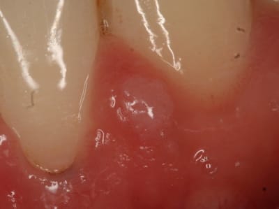 Img 7941 ubvsrb - Eugenol