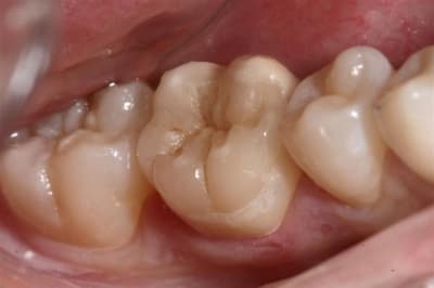 Img 7947  large  w0d0tl - Eugenol
