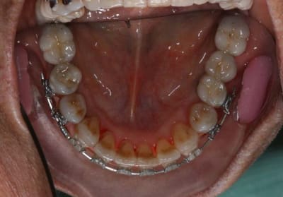 Img 7 teufpy - Eugenol