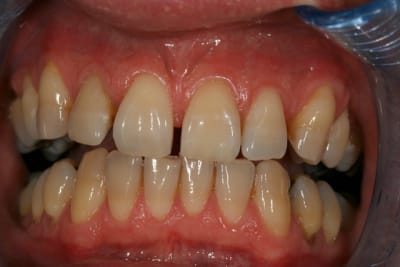 Img 8424 petite wk8jgt - Eugenol