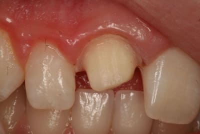 Img 8868 qywj7i - Eugenol