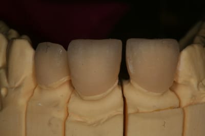 Img 8917 daqy0m - Eugenol