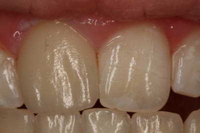 Img 8943 jjtc3h - Eugenol