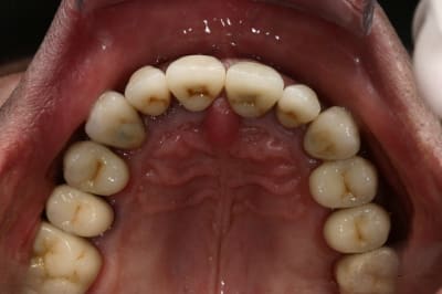 Img 9035 y7gnbz - Eugenol