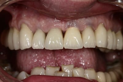 Img 9081 epxss5 - Eugenol