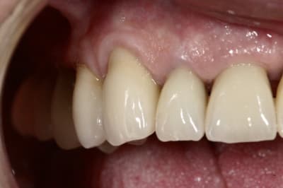 Img 9082 eplzsm - Eugenol