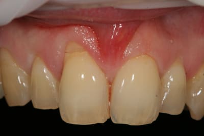 Img 9685 pvamp0 - Eugenol