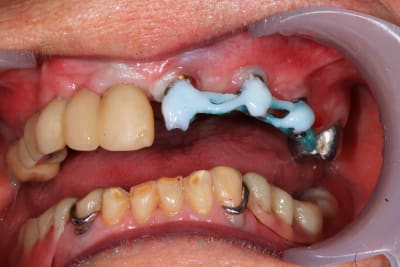 Img 9860 2 vpmfp7 - Eugenol