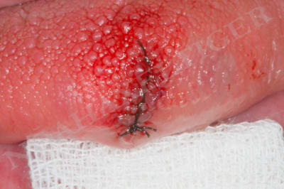 Img 9922 loeb0m - Eugenol