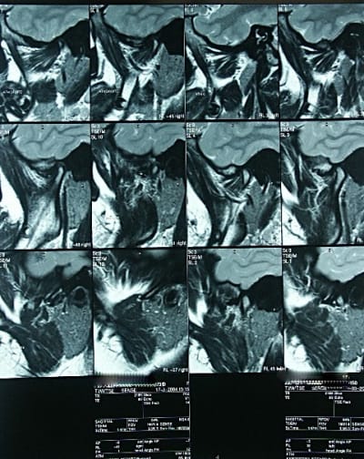 Irmatm tb9z6p - Eugenol