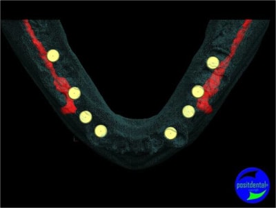 Image14 xo1hdx - Eugenol