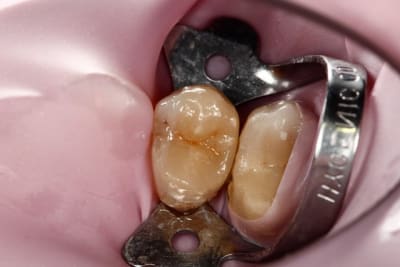 Image16 am6s2u - Eugenol