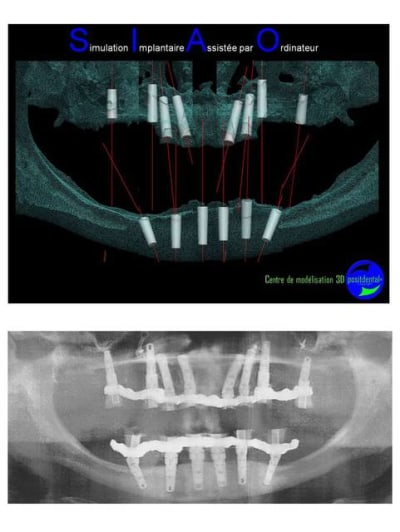 Image18 ejrj1n - Eugenol