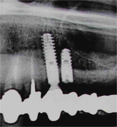 Image1 fhugwl - Eugenol