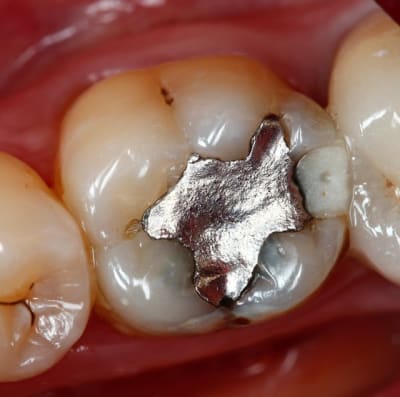 Image1 k6xvae - Eugenol