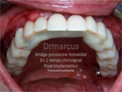 Image1 migv9k - Eugenol