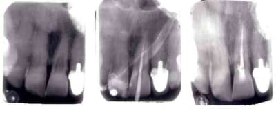 Image1 u8nilj - Eugenol