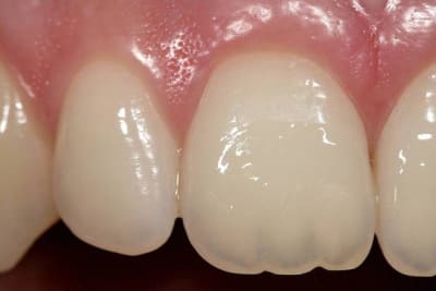 Image1 vkkbyu - Eugenol