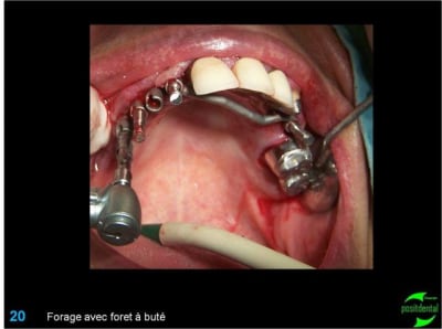 Image20 xpbv2p - Eugenol