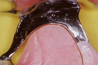 Image2 ehrvin - Eugenol