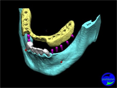 Image2 hxy0eg - Eugenol
