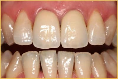 Image2 lzku76 - Eugenol