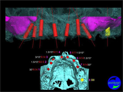 Image30 exkkml - Eugenol