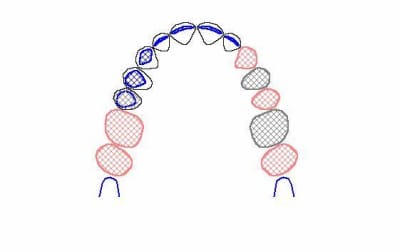 Image31 dtstfs - Eugenol