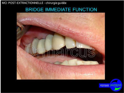 Image35 mxavav - Eugenol