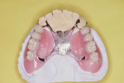 Image3 bbrxqe - Eugenol