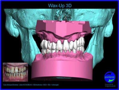 Image3 h0bwfe - Eugenol