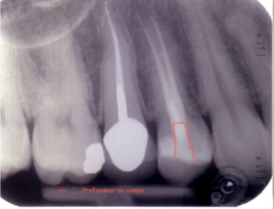 Image3 i8hiyp - Eugenol