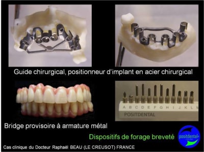 Image3 jqw175 - Eugenol