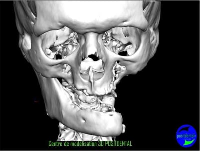 Image3 u2mwcw - Eugenol