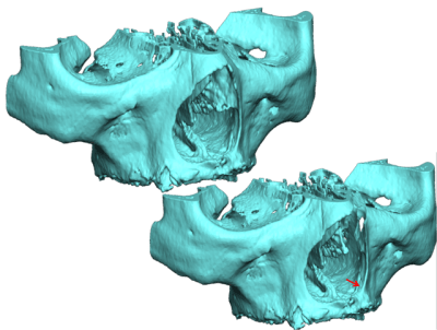 Image3 unmmx7 - Eugenol