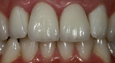 Image44444 sut9x3 - Eugenol